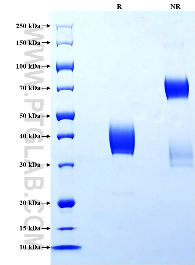 Purity of Recombinant Human NRG4 was determined by SDS-PAGE. The protein was resolved in an SDS-PAGE in reducing (R) and non-reducing (NR) conditions and stained using Coomassie blue. Purity of Recombinant Human NRG4 was determined by SDS-PAGE. The protein was resolved in an SDS-PAGE in reducing (R) and non-reducing (NR) conditions and stained using Coomassie blue.