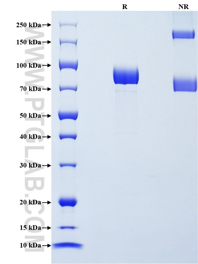 Purity of Recombinant Human PSG1 was determined by SDS-PAGE. The protein was resolved in an SDS-PAGE in reducing (R) and non-reducing (NR) conditions and stained using Coomassie blue. Purity of Recombinant Human PSG1 was determined by SDS-PAGE. The protein was resolved in an SDS-PAGE in reducing (R) and non-reducing (NR) conditions and stained using Coomassie blue.