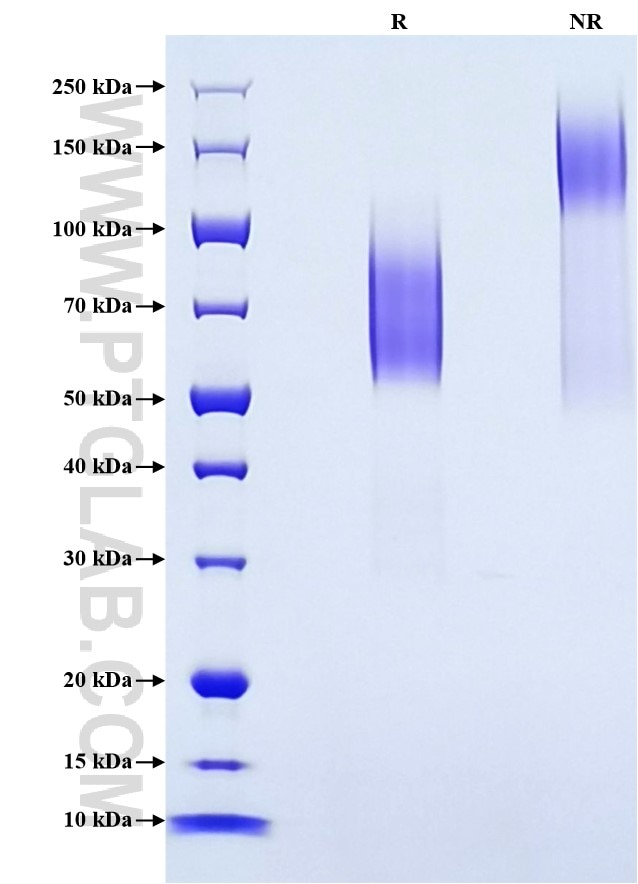 Purity of Recombinant Human EVI2B was determined by SDS-PAGE. The protein was resolved in an SDS-PAGE in reducing (R) and non-reducing (NR) conditions and stained using Coomassie blue.