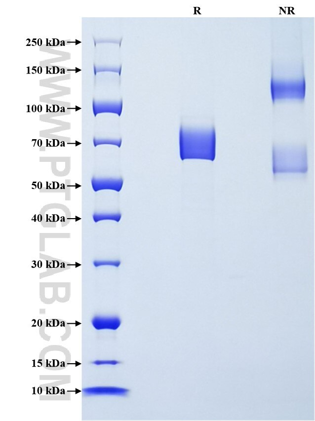 Purity of Recombinant Human FCRL1 was determined by SDS-PAGE. The protein was resolved in an SDS-PAGE in reducing (R) and non-reducing (NR) conditions and stained using Coomassie blue.