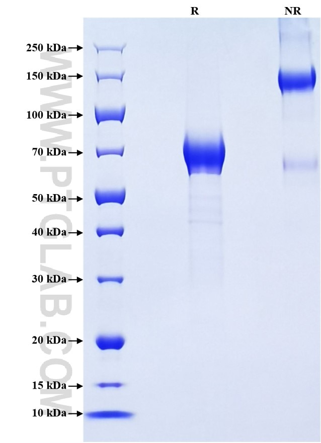 Purity of Recombinant Human CD158G was determined by SDS-PAGE. The protein was resolved in an SDS-PAGE in reducing (R) and non-reducing (NR) conditions and stained using Coomassie blue.
