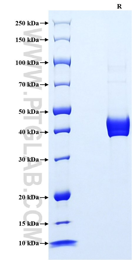 Purity of Recombinant Human S100A8 was determined by SDS-PAGE. The protein was resolved in an SDS-PAGE in reducing (R) conditions and stained using Coomassie blue.