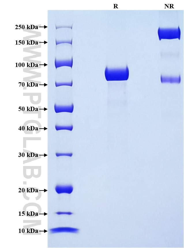 Purity of Recombinant Human LILRA6 was determined by SDS-PAGE. The protein was resolved in an SDS-PAGE in reducing (R) and non-reducing (NR) conditions and stained using Coomassie blue.