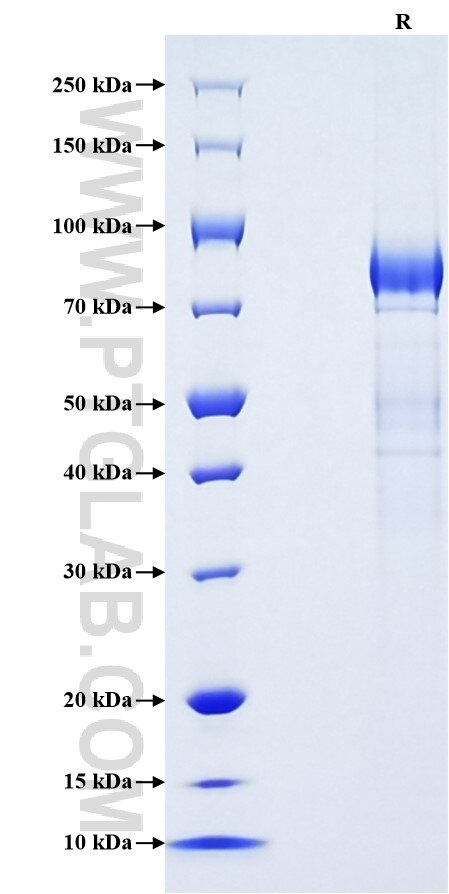 Purity of Recombinant Human KIR3DL2 was determined by SDS-PAGE. The protein was resolved in an SDS-PAGE in reducing (R) conditions and stained using Coomassie blue. Purity of Recombinant Human KIR3DL2 was determined by SDS-PAGE. The protein was resolved in an SDS-PAGE in reducing (R) conditions and stained using Coomassie blue.