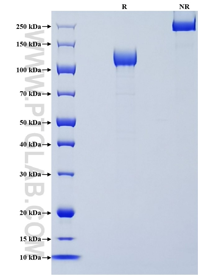 Purity of Recombinant Human ALK was determined by SDS-PAGE. The protein was resolved in an SDS-PAGE in reducing (R) and non-reducing (NR) conditions and stained using Coomassie blue.