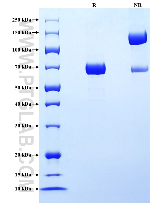 Purity of Recombinant Human Serpin E1 was determined by SDS-PAGE. The protein was resolved in an SDS-PAGE in reducing (R) and non-reducing (NR) conditions and stained using Coomassie blue.