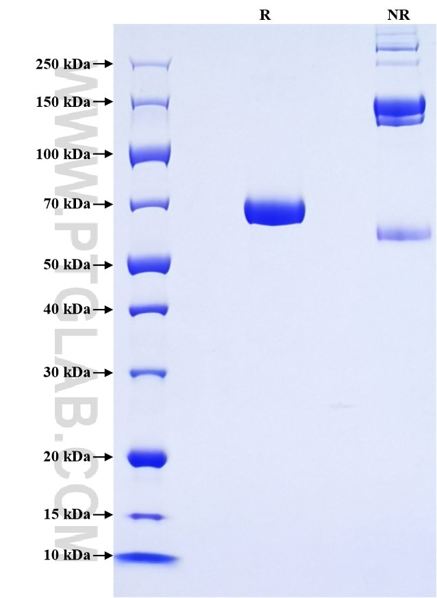 Purity of Recombinant Rat IL-12B was determined by SDS-PAGE. The protein was resolved in an SDS-PAGE in reducing (R) and non-reducing (NR) conditions and stained using Coomassie blue. Purity of Recombinant Rat IL-12B was determined by SDS-PAGE. The protein was resolved in an SDS-PAGE in reducing (R) and non-reducing (NR) conditions and stained using Coomassie blue.