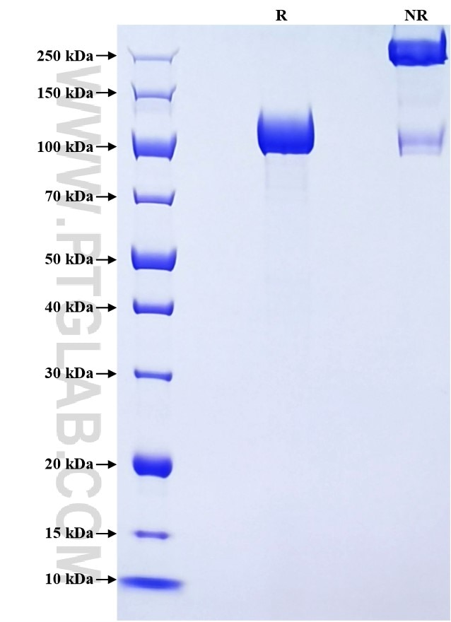 Purity of Recombinant Rat Vcam1 was determined by SDS-PAGE. The protein was resolved in an SDS-PAGE in reducing (R) and non-reducing (NR) conditions and stained using Coomassie blue.