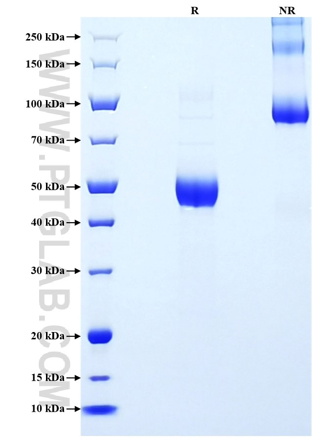 Purity of Recombinant Mouse Il-7 was determined by SDS-PAGE. The protein was resolved in an SDS-PAGE in reducing (R) and non-reducing (NR) conditions and stained using Coomassie blue. Purity of Recombinant Mouse Il-7 was determined by SDS-PAGE. The protein was resolved in an SDS-PAGE in reducing (R) and non-reducing (NR) conditions and stained using Coomassie blue.