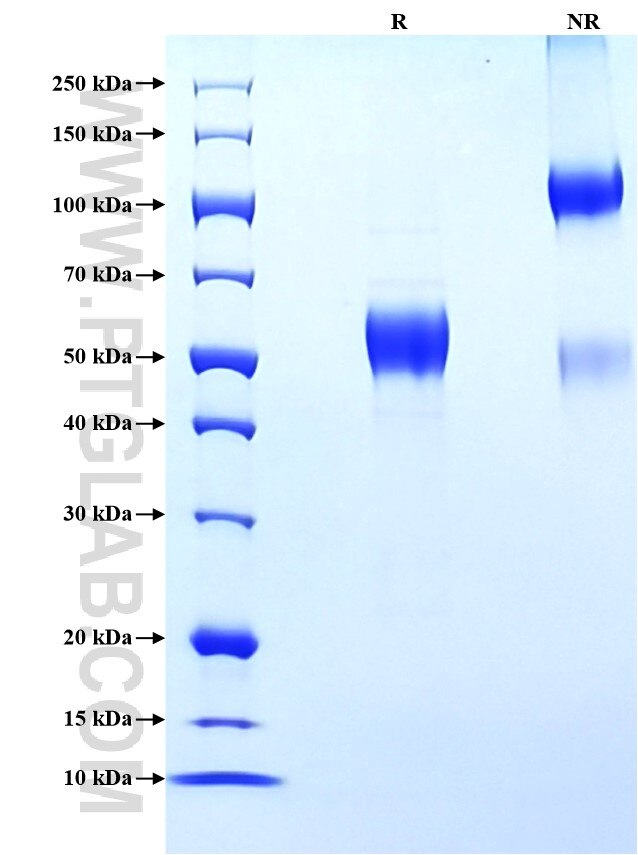 Purity of Recombinant Mouse IL-9 was determined by SDS-PAGE. The protein was resolved in an SDS-PAGE in reducing (R) and non-reducing (NR) conditions and stained using Coomassie blue.