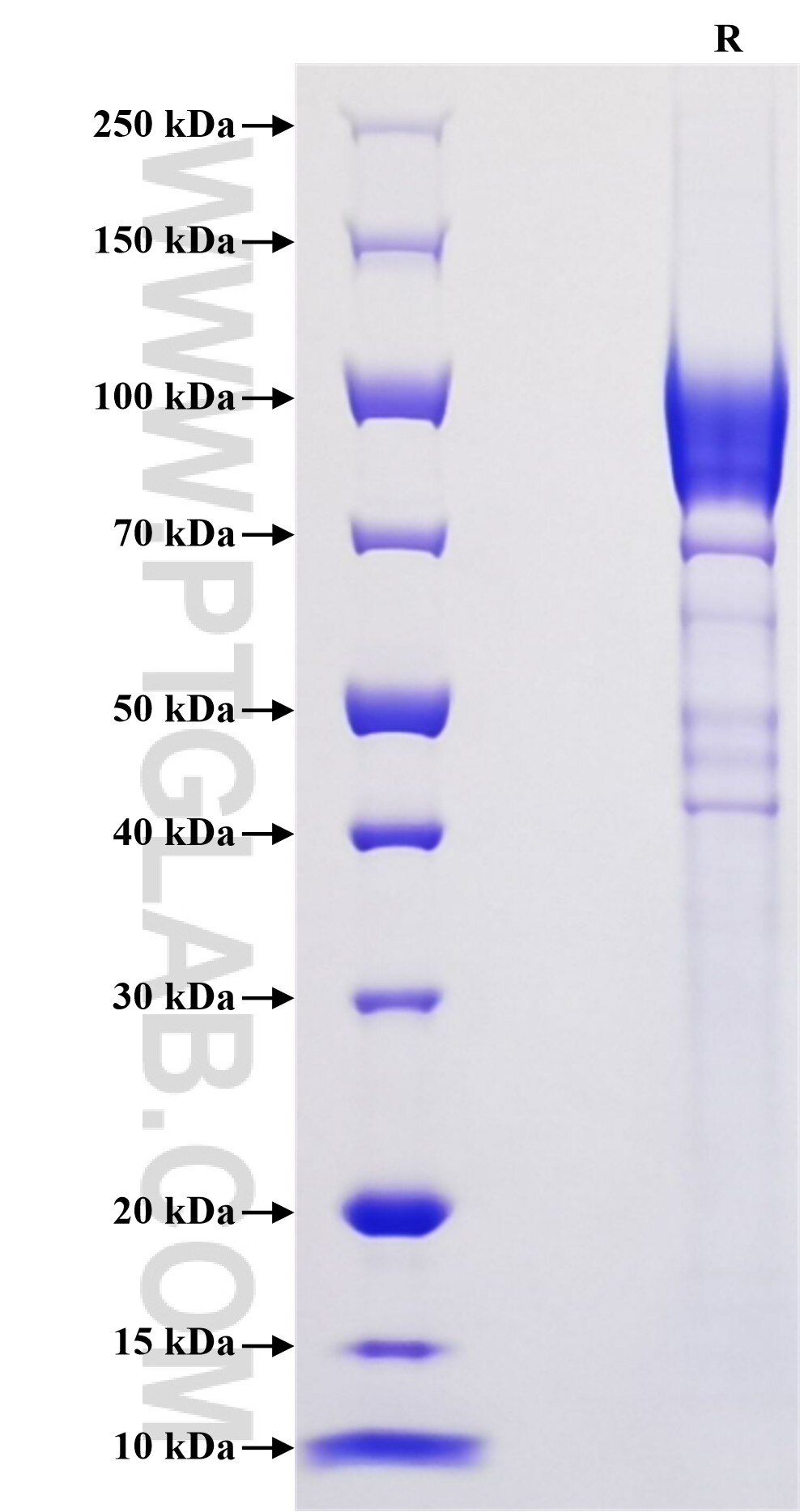 Purity of Recombinant Mouse CD62L was determined by SDS-PAGE. The protein was resolved in an SDS-PAGE in reducing (R) conditions and stained using Coomassie blue. Purity of Recombinant Mouse CD62L was determined by SDS-PAGE. The protein was resolved in an SDS-PAGE in reducing (R) conditions and stained using Coomassie blue.