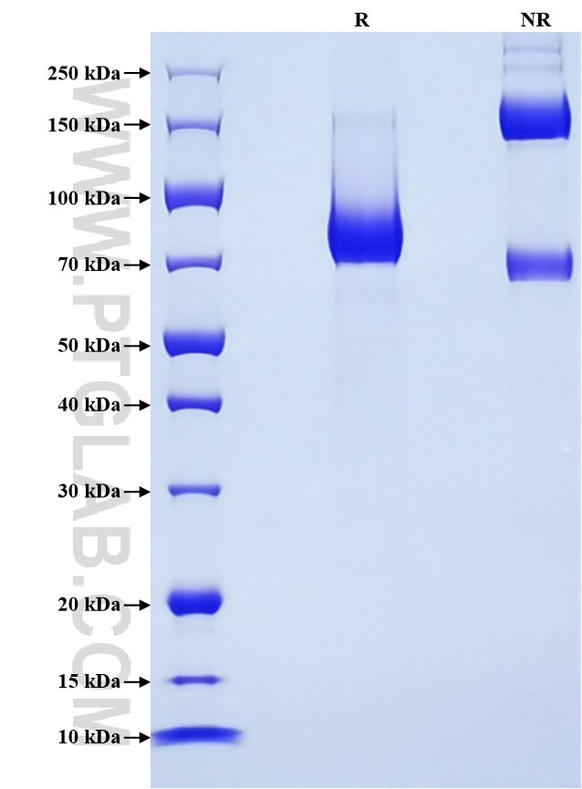 Purity of Recombinant Mouse CD4 was determined by SDS-PAGE. The protein was resolved in an SDS-PAGE in reducing (R) and non-reducing (NR) conditions and stained using Coomassie blue.