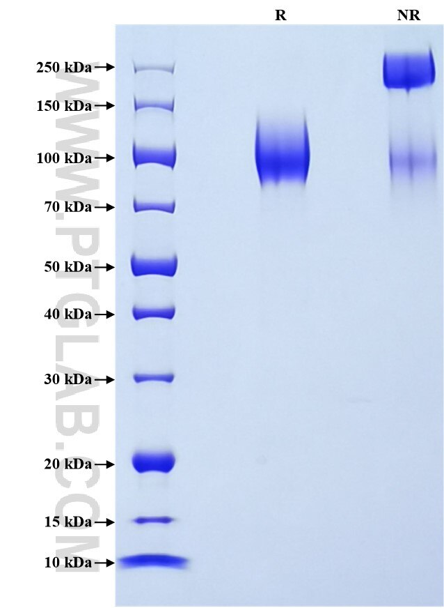 Purity of Recombinant Mouse LAMP-1 was determined by SDS-PAGE. The protein was resolved in an SDS-PAGE in reducing (R) and non-reducing (NR) conditions and stained using Coomassie blue.