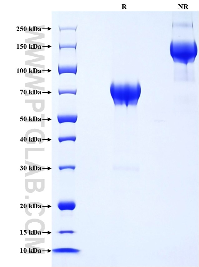 Purity of Recombinant Mouse p75NTR was determined by SDS-PAGE. The protein was resolved in an SDS-PAGE in reducing (R) and non-reducing (NR) conditions and stained using Coomassie blue.