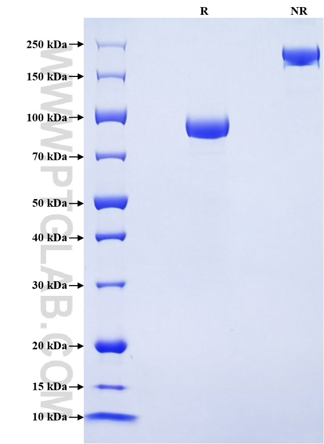 Purity of Recombinant Human LILRB2 was determined by SDS-PAGE. The protein was resolved in an SDS-PAGE in reducing (R) and non-reducing (NR) conditions and stained using Coomassie blue. Purity of Recombinant Human LILRB2 was determined by SDS-PAGE. The protein was resolved in an SDS-PAGE in reducing (R) and non-reducing (NR) conditions and stained using Coomassie blue.