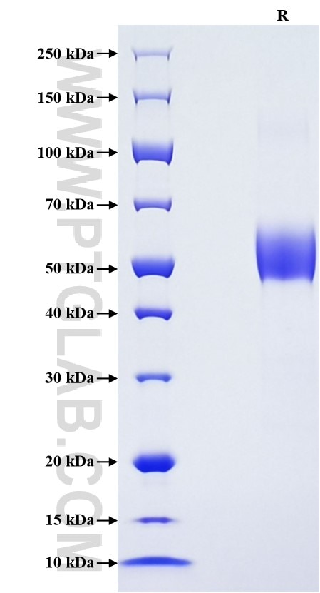 Purity of Recombinant Rat Fas was determined by SDS-PAGE. The protein was resolved in an SDS-PAGE in reducing (R) conditions and stained using Coomassie blue. Purity of Recombinant Rat Fas was determined by SDS-PAGE. The protein was resolved in an SDS-PAGE in reducing (R) conditions and stained using Coomassie blue.