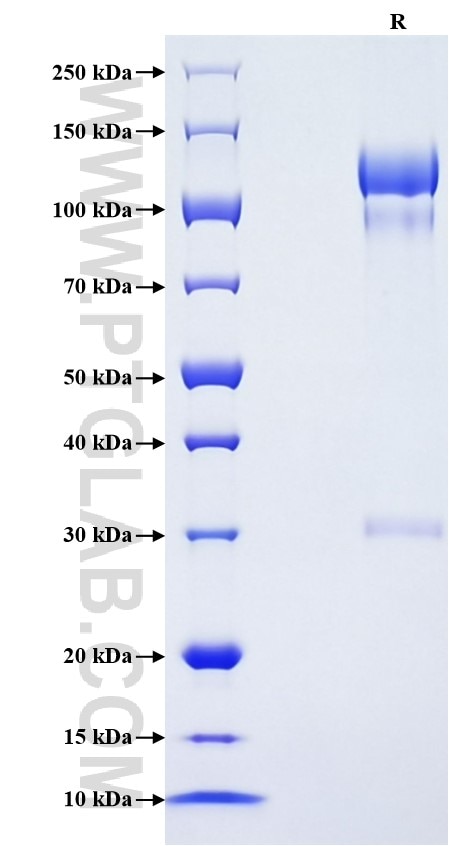 Purity of Recombinant Mouse Uromodulin was determined by SDS-PAGE. The protein was resolved in an SDS-PAGE in reducing (R) conditions and stained using Coomassie blue.