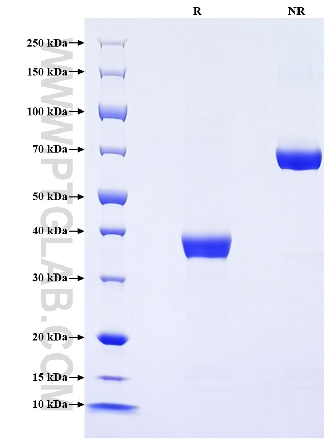 Purity of Recombinant Human CXCL3 was determined by SDS-PAGE. The protein was resolved in an SDS-PAGE in reducing (R) and non-reducing (NR) conditions and stained using Coomassie blue.