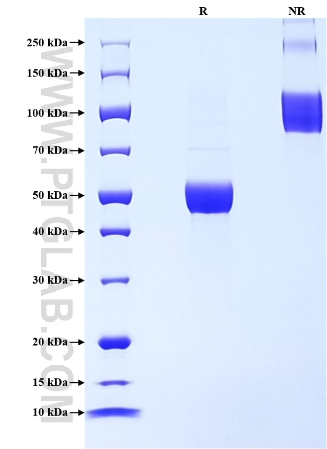 Purity of Recombinant Human TDGF1 was determined by SDS-PAGE. The protein was resolved in an SDS-PAGE in reducing (R) and non-reducing (NR) conditions and stained using Coomassie blue. Purity of Recombinant Human TDGF1 was determined by SDS-PAGE. The protein was resolved in an SDS-PAGE in reducing (R) and non-reducing (NR) conditions and stained using Coomassie blue.