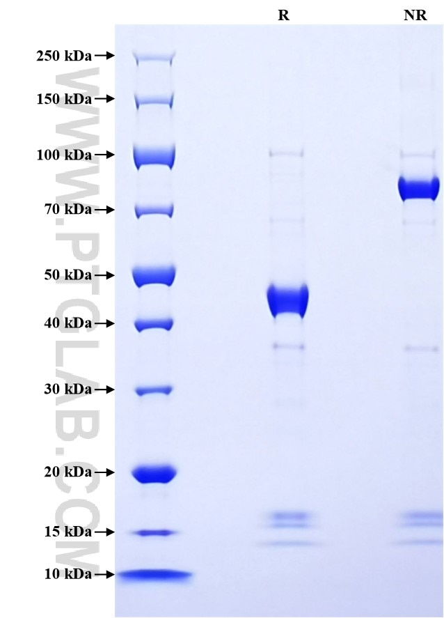 Purity of Recombinant Mouse Midkine was determined by SDS-PAGE. The protein was resolved in an SDS-PAGE in reducing (R) and non-reducing (NR) conditions and stained using Coomassie blue.