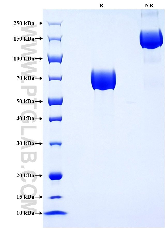 Purity of Recombinant Human GHR was determined by SDS-PAGE. The protein was resolved in an SDS-PAGE in reducing (R) and non-reducing (NR) conditions and stained using Coomassie blue. Purity of Recombinant Human GHR was determined by SDS-PAGE. The protein was resolved in an SDS-PAGE in reducing (R) and non-reducing (NR) conditions and stained using Coomassie blue.
