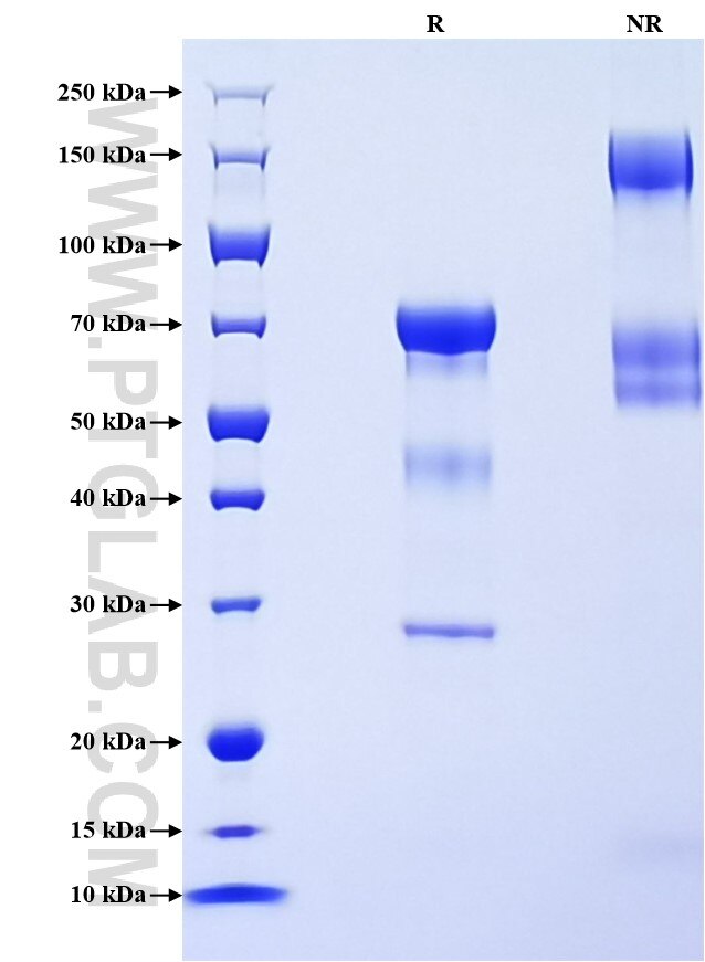 Purity of Recombinant Mouse Cathepsin B was determined by SDS-PAGE. The protein was resolved in an SDS-PAGE in reducing (R) and non-reducing (NR) conditions and stained using Coomassie blue. Purity of Recombinant Mouse Cathepsin B was determined by SDS-PAGE. The protein was resolved in an SDS-PAGE in reducing (R) and non-reducing (NR) conditions and stained using Coomassie blue.