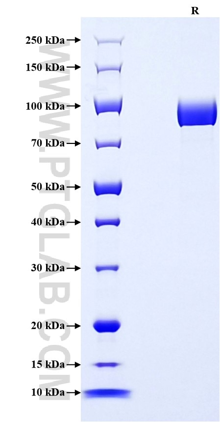 Purity of Recombinant Human ALPI was determined by SDS-PAGE. The protein was resolved in an SDS-PAGE in reducing (R) conditions and stained using Coomassie blue.