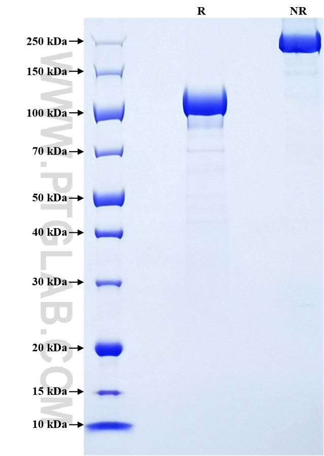 Purity of Recombinant Human Tie1 was determined by SDS-PAGE. The protein was resolved in an SDS-PAGE in reducing (R) and non-reducing (NR) conditions and stained using Coomassie blue.
