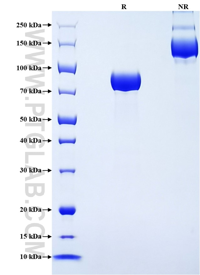 Purity of Recombinant Mouse Antithrombin III was determined by SDS-PAGE. The protein was resolved in an SDS-PAGE in reducing (R) and non-reducing (NR) conditions and stained using Coomassie blue. Purity of Recombinant Mouse Antithrombin III was determined by SDS-PAGE. The protein was resolved in an SDS-PAGE in reducing (R) and non-reducing (NR) conditions and stained using Coomassie blue.