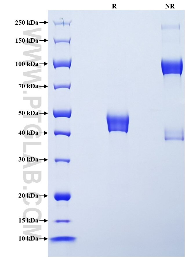 Purity of Recombinant Human AMACR was determined by SDS-PAGE. The protein was resolved in an SDS-PAGE in reducing (R) and non-reducing (NR) conditions and stained using Coomassie blue.