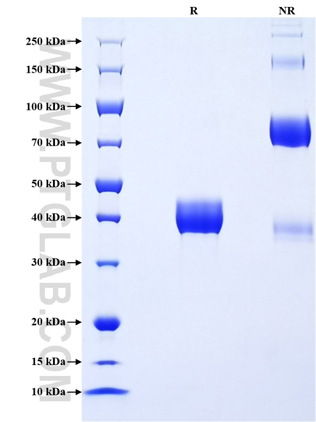 Purity of Recombinant Mouse S100A8 was determined by SDS-PAGE. The protein was resolved in an SDS-PAGE in reducing (R) and non-reducing (NR) conditions and stained using Coomassie blue. Purity of Recombinant Mouse S100A8 was determined by SDS-PAGE. The protein was resolved in an SDS-PAGE in reducing (R) and non-reducing (NR) conditions and stained using Coomassie blue.