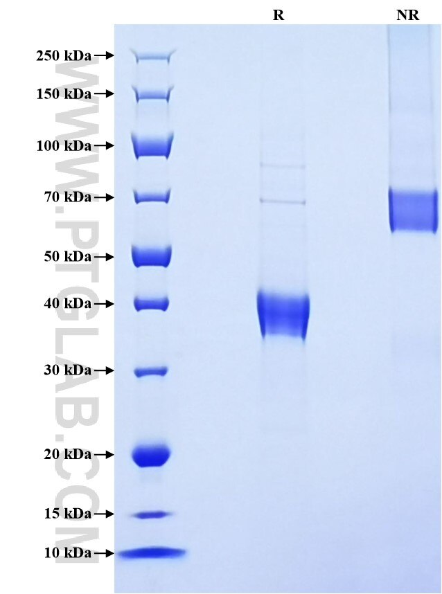 Purity of Recombinant Human DEFB119 was determined by SDS-PAGE. The protein was resolved in an SDS-PAGE in reducing (R) and non-reducing (NR) conditions and stained using Coomassie blue. Purity of Recombinant Human DEFB119 was determined by SDS-PAGE. The protein was resolved in an SDS-PAGE in reducing (R) and non-reducing (NR) conditions and stained using Coomassie blue.