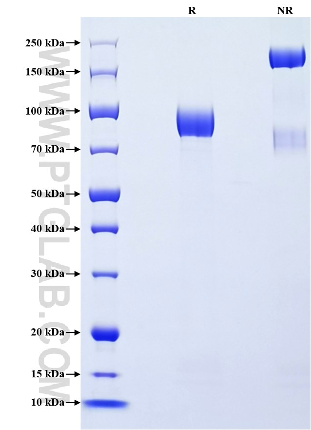 Purity of Recombinant Human GFRA2 was determined by SDS-PAGE. The protein was resolved in an SDS-PAGE in reducing (R) and non-reducing (NR) conditions and stained using Coomassie blue.