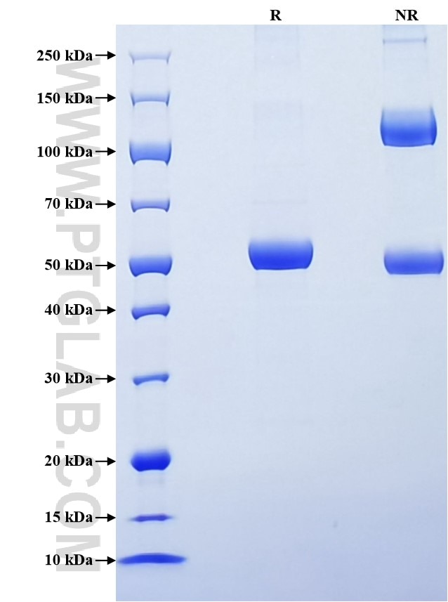 Purity of Recombinant Mouse Cardiotrophin-1 was determined by SDS-PAGE. The protein was resolved in an SDS-PAGE in reducing (R) and non-reducing (NR) conditions and stained using Coomassie blue.
