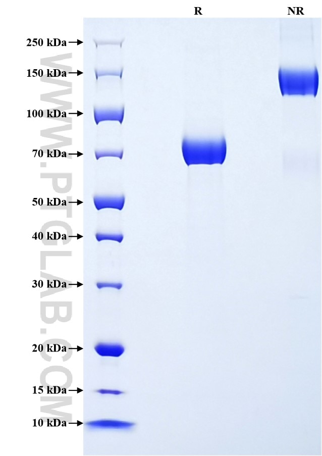 Purity of Recombinant Human SIGLEC14 was determined by SDS-PAGE. The protein was resolved in an SDS-PAGE in reducing (R) and non-reducing (NR) conditions and stained using Coomassie blue. Purity of Recombinant Human SIGLEC14 was determined by SDS-PAGE. The protein was resolved in an SDS-PAGE in reducing (R) and non-reducing (NR) conditions and stained using Coomassie blue.