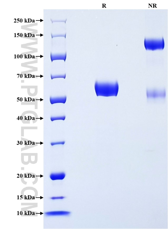 Purity of Recombinant Human Ephrin B1 was determined by SDS-PAGE. The protein was resolved in an SDS-PAGE in reducing (R) and non-reducing (NR) conditions and stained using Coomassie blue.