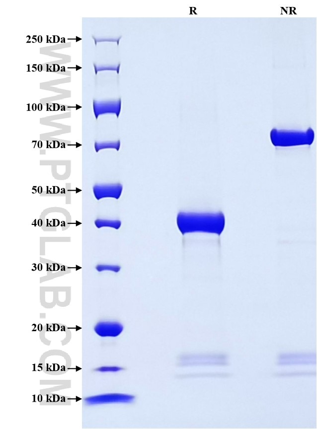 Purity of Recombinant Mouse SLPI was determined by SDS-PAGE. The protein was resolved in an SDS-PAGE in reducing (R) and non-reducing (NR) conditions and stained using Coomassie blue. Purity of Recombinant Mouse SLPI was determined by SDS-PAGE. The protein was resolved in an SDS-PAGE in reducing (R) and non-reducing (NR) conditions and stained using Coomassie blue.
