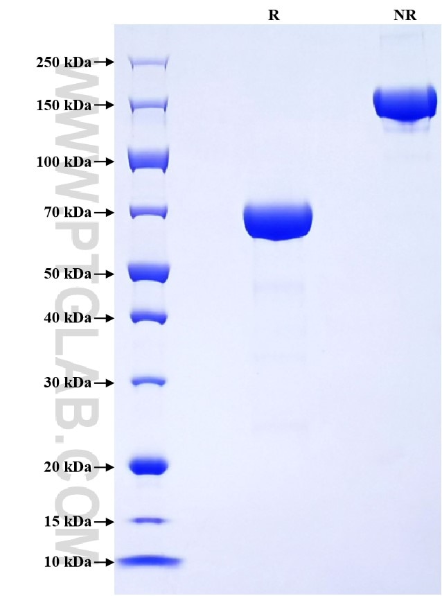 Purity of Recombinant Mouse IL-17RB was determined by SDS-PAGE. The protein was resolved in an SDS-PAGE in reducing (R) and non-reducing (NR) conditions and stained using Coomassie blue.