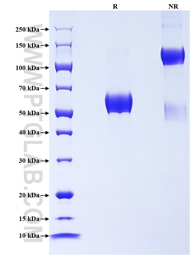Purity of Recombinant Mouse VISTA was determined by SDS-PAGE. The protein was resolved in an SDS-PAGE in reducing (R) and non-reducing (NR) conditions and stained using Coomassie blue. Purity of Recombinant Mouse VISTA was determined by SDS-PAGE. The protein was resolved in an SDS-PAGE in reducing (R) and non-reducing (NR) conditions and stained using Coomassie blue.