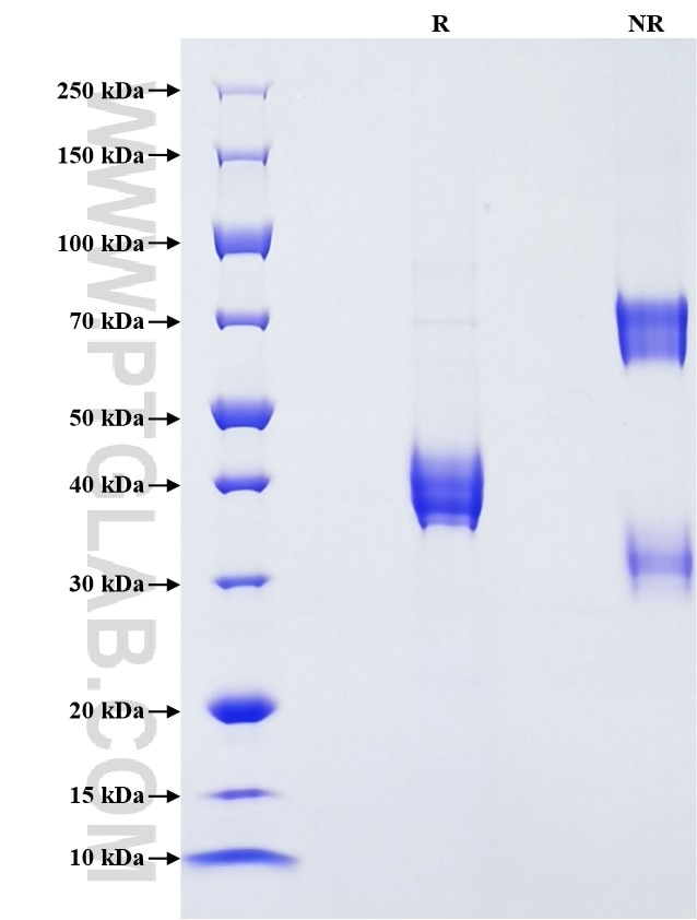 Purity of Recombinant Human C5 was determined by SDS-PAGE. The protein was resolved in an SDS-PAGE in reducing (R) and non-reducing (NR) conditions and stained using Coomassie blue. Purity of Recombinant Human C5 was determined by SDS-PAGE. The protein was resolved in an SDS-PAGE in reducing (R) and non-reducing (NR) conditions and stained using Coomassie blue.
