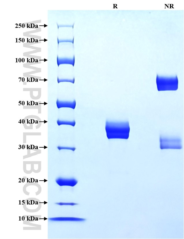 Purity of Recombinant Rat CXCL2 was determined by SDS-PAGE. The protein was resolved in an SDS-PAGE in reducing (R) and non-reducing (NR) conditions and stained using Coomassie blue. Purity of Recombinant Rat CXCL2 was determined by SDS-PAGE. The protein was resolved in an SDS-PAGE in reducing (R) and non-reducing (NR) conditions and stained using Coomassie blue.