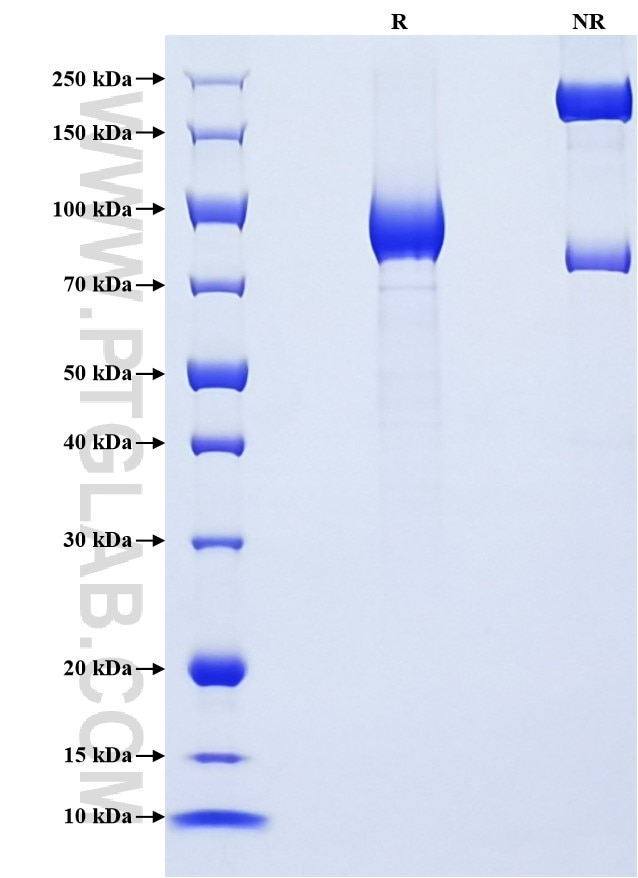 Purity of Recombinant Human EPHB6 was determined by SDS-PAGE. The protein was resolved in an SDS-PAGE in reducing (R) and non-reducing (NR) conditions and stained using Coomassie blue. Purity of Recombinant Human EPHB6 was determined by SDS-PAGE. The protein was resolved in an SDS-PAGE in reducing (R) and non-reducing (NR) conditions and stained using Coomassie blue.