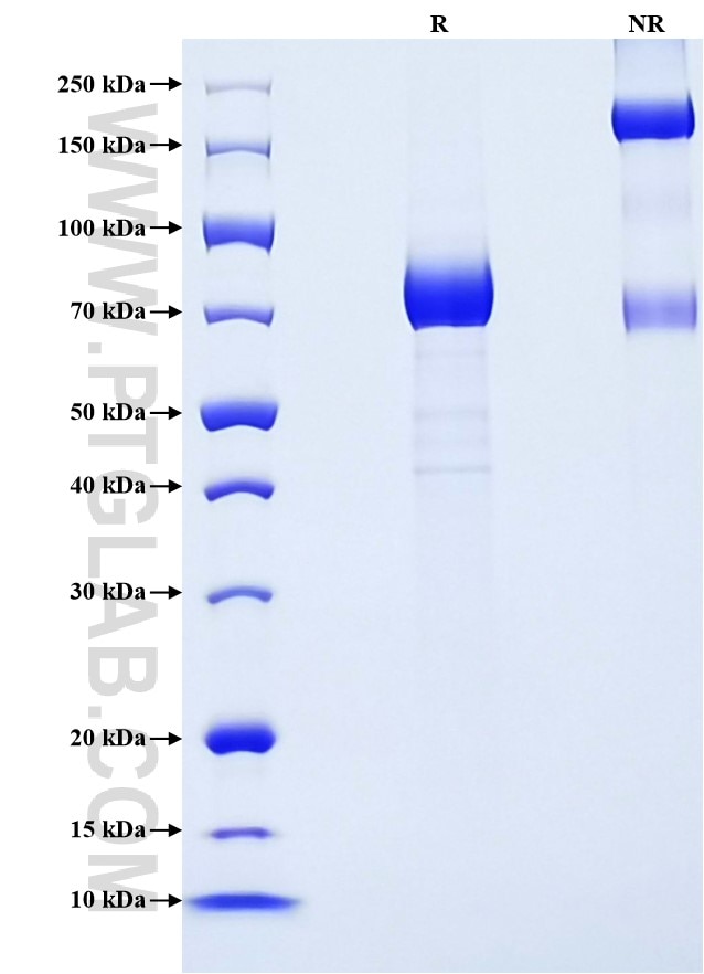 Purity of Recombinant Human KIR3DL1 was determined by SDS-PAGE. The protein was resolved in an SDS-PAGE in reducing (R) and non-reducing (NR) conditions and stained using Coomassie blue.