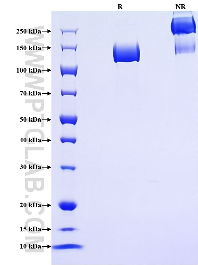Purity of Recombinant Mouse ENPEP was determined by SDS-PAGE. The protein was resolved in an SDS-PAGE in reducing (R) and non-reducing (NR) conditions and stained using Coomassie blue. Purity of Recombinant Mouse ENPEP was determined by SDS-PAGE. The protein was resolved in an SDS-PAGE in reducing (R) and non-reducing (NR) conditions and stained using Coomassie blue.