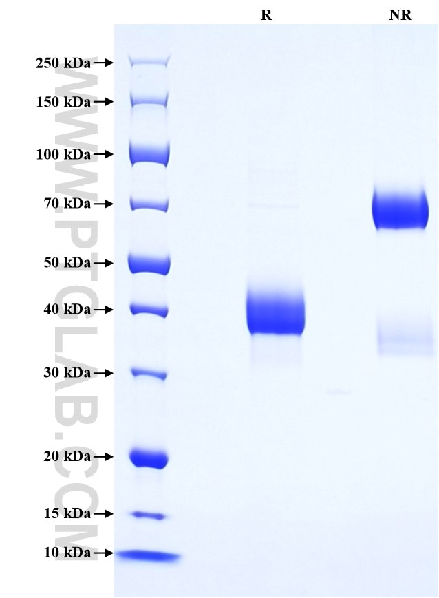 Purity of Recombinant Human CCL23 was determined by SDS-PAGE. The protein was resolved in an SDS-PAGE in reducing (R) and non-reducing (NR) conditions and stained using Coomassie blue. Purity of Recombinant Human CCL23 was determined by SDS-PAGE. The protein was resolved in an SDS-PAGE in reducing (R) and non-reducing (NR) conditions and stained using Coomassie blue.