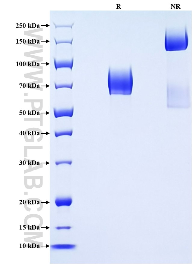 Purity of Recombinant Human CD55 was determined by SDS-PAGE. The protein was resolved in an SDS-PAGE in reducing (R) and non-reducing (NR) conditions and stained using Coomassie blue.
