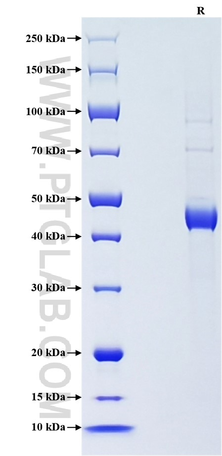 Purity of Recombinant Human LHB was determined by SDS-PAGE. The protein was resolved in an SDS-PAGE in reducing (R) conditions and stained using Coomassie blue.