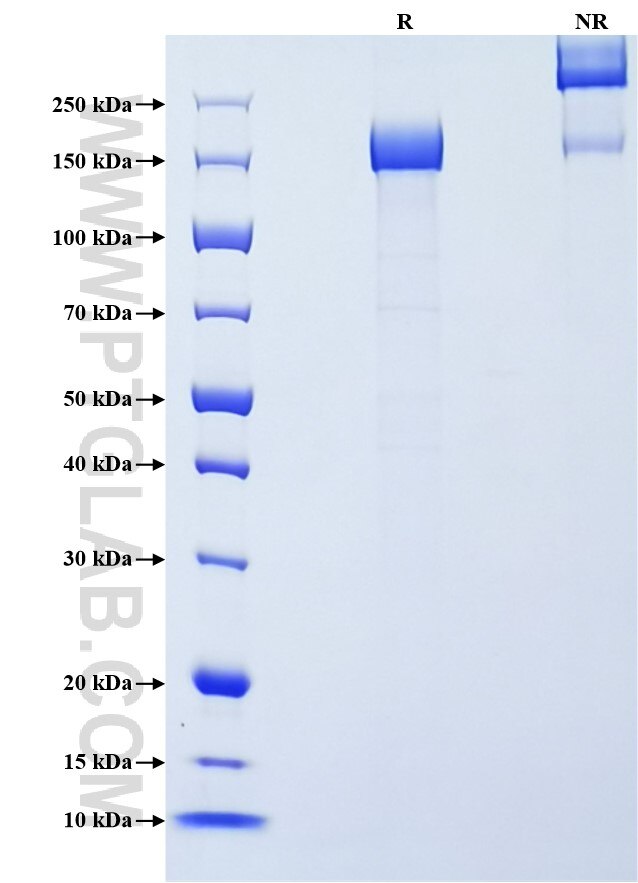Purity of Recombinant Mouse G-CSFR was determined by SDS-PAGE. The protein was resolved in an SDS-PAGE in reducing (R) and non-reducing (NR) conditions and stained using Coomassie blue. Purity of Recombinant Mouse G-CSFR was determined by SDS-PAGE. The protein was resolved in an SDS-PAGE in reducing (R) and non-reducing (NR) conditions and stained using Coomassie blue.