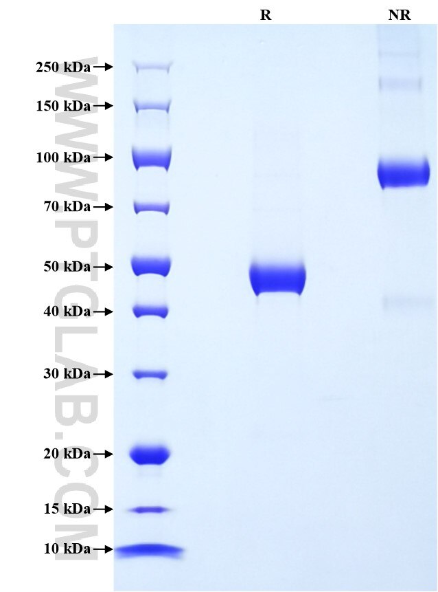 Purity of Recombinant Human MASP1 was determined by SDS-PAGE. The protein was resolved in an SDS-PAGE in reducing (R) and non-reducing (NR) conditions and stained using Coomassie blue.