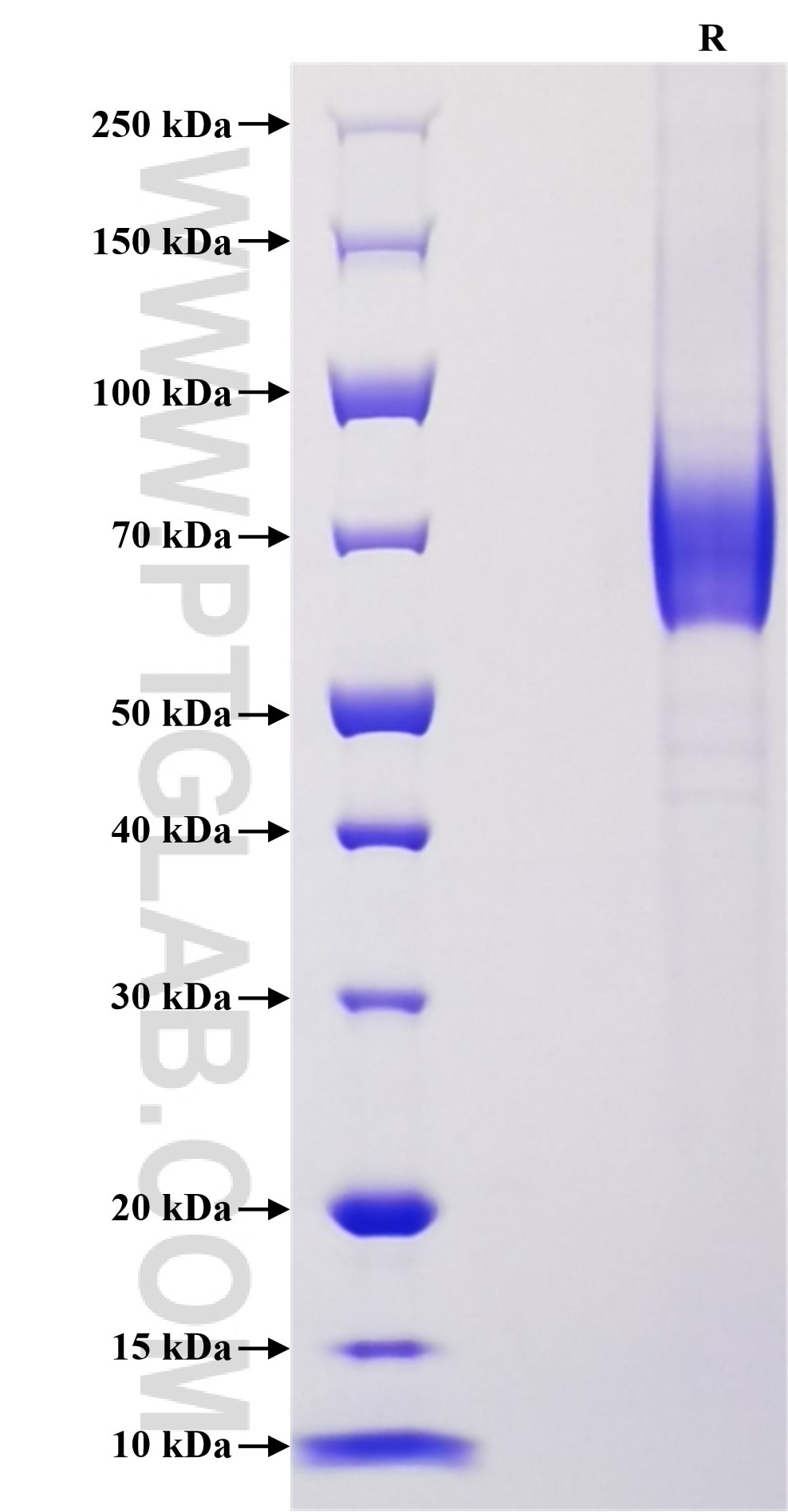 Purity of Recombinant Rat IFN-gamma R1 was determined by SDS-PAGE. The protein was resolved in an SDS-PAGE in reducing (R) conditions and stained using Coomassie blue. Purity of Recombinant Rat IFN-gamma R1 was determined by SDS-PAGE. The protein was resolved in an SDS-PAGE in reducing (R) conditions and stained using Coomassie blue.